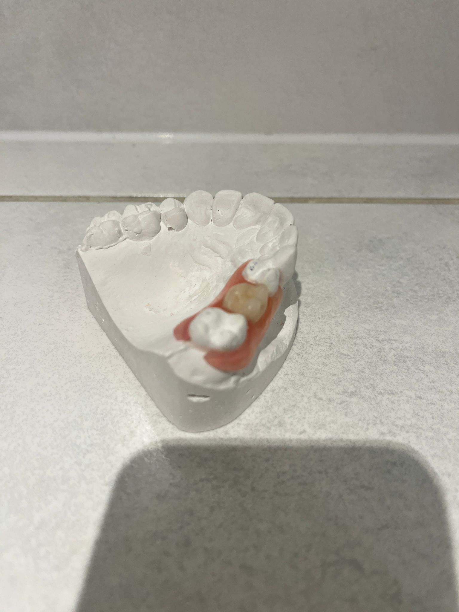 Mikro proteza acetalowa Duracetal
